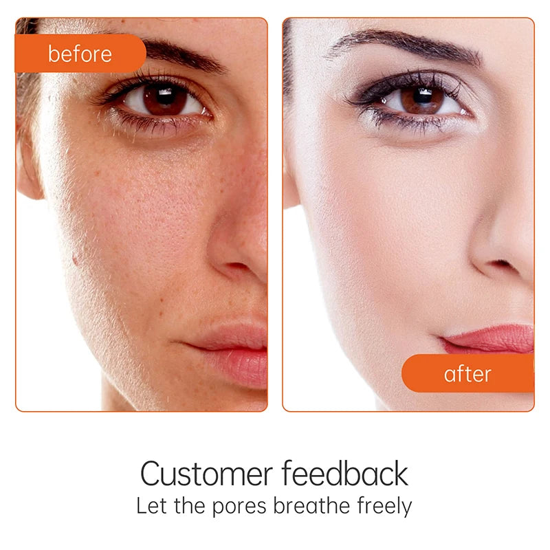 Retinol Vitamin C Face Cream - Anti-Wrinkle Brightening Moisturizer